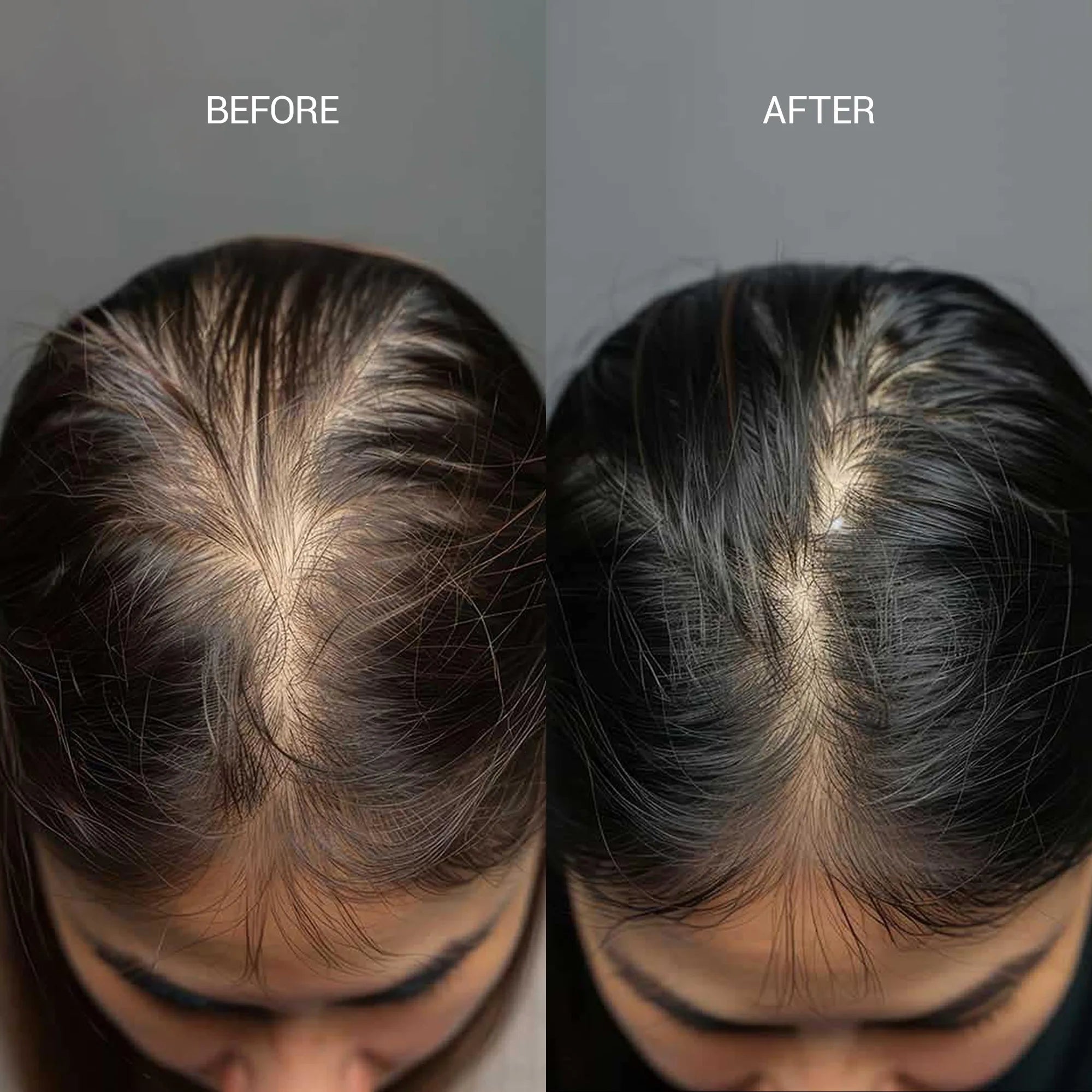 Awaken Hair & Scalp Serum